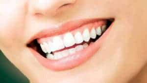 seacliff dental San Francisco white teeth healthy smile